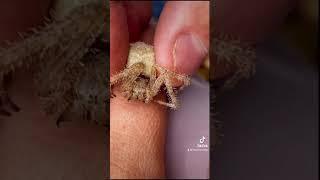 La morsure d’Araneus cavaticus, une araignée sans danger pour l’humain. #spider #wildlife