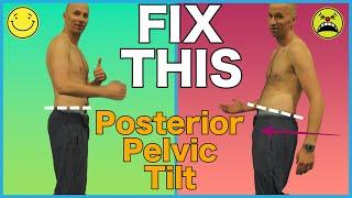 FIX Posterior Pelvic Tilt with 2 Exercises