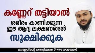 കണ്ണേറിൻ്റെ ആദ്യ ലക്ഷണങ്ങൾ | Kanneru malayalam | Rabeeh faizy islamic speech