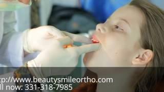 Best Top Orthodontist Near Me in Channahon IL Free Consultation 331-318-7985