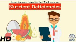 Nutrient Deficiencies: Recognizing and Preventing the 7 Most Common Deficits!