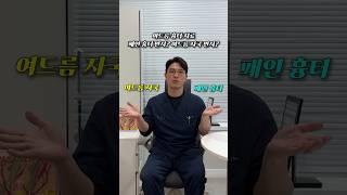 여드름자국 VS 패인흉터