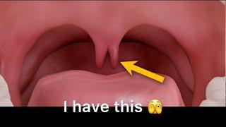 Visit the #ENT Doctor with me #uvula #nasal