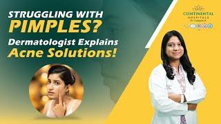 Struggling with Pimples? Best Acne Treatment in Gachibowli Hyderabad! | Continental Hospitals