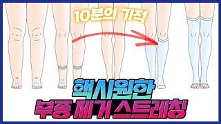 15분후면 다리 붓기가 쫘악!! 골반과 고관절에 파스 붙인듯한 소름 돋는 스트레칭