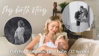 My Birth Story | Positive Birth at 37 Weeks | Polyhydramnios | Vacuum Assisted