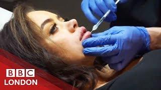 Plastic surgery gone wrong: 'My lip was about to fall off' - BBC London