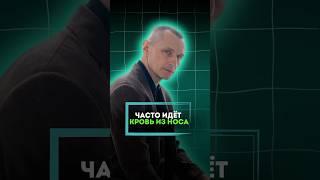 ЧАСТО ИДЕТ КРОВЬ ИЗ НОСА #алексейкапустин #докторкапустин #народнаямедицина #кровь #нос #лечение