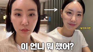 Everything I Did to My Face: Skin Treatments Exposed 