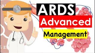 Acute Respiratory Distress Syndrome (ARDS) Advanced - Management | Clinical Medicine