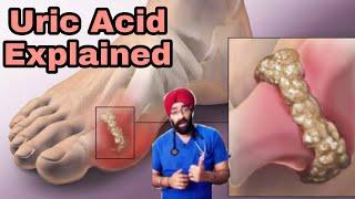 Uric Acid Problem Explained | Natural Cure & Diet | Dr.Education (Hindi)