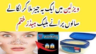 How To Remove BLACKHEADS at Home | In Just 5 Mints Best Way to Remove BLACKHEADS With Vaseline