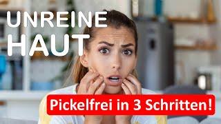 Pickelfrei in 3 Schritten - Natürliche Lösungen für strahlende Haut