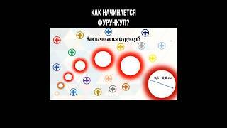 Как начинается фурункул? #стафилококк #фурункул #фурункулез #здороваякожа