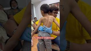 Chiropractic treatment for scoliosis #drrajneeshkant