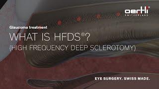 Spotlight: What is HFDS? | Glaucoma treatment