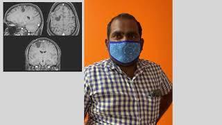 The best brain tumor surgery hospital in Andhra Pradesh - Dr. Rao's Hospital, best neuro hospital