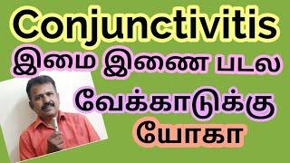 conjunctivitis - yoga இமை இணை படல வேக்காடு க்கு யோகா பயிற்சி,