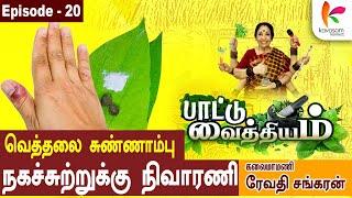 சுத்தி சுத்தி வலிச்சீங்க... l நகச்சுற்று l Paattu Vaithiyam 20  l Revathi Sankaran  l #episode20