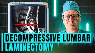 Decompressive Lumbar Laminectomy Procedure | What to Expect