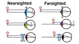 Physics - Optics: Vision Correction (1 of 5) Introduction
