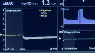 Dräger Perseus® A500 - Smart Features Part 1: Vaporview