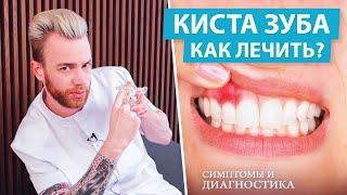 Киста зуба - как лечить. Симптомы и диагностика кисты зуба