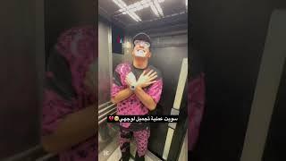 سويت عملية تجميل ️‍🩹 ( انصدمت بشكلي بالنهاية ) #shorts