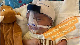 Trisomy 18 Kids Are Worth Fighting For!