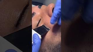 Blackheads & White Heads Ka Solution | Mridul Madhok