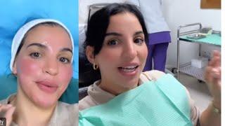 اسماء بيوتي بعد عملية التجميل🫢