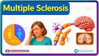 1. Multiple Sclerosis Internal Medicine  Symptoms, Diagnosis & Treatment | NEET PG/FMGE/USMLE