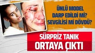 ÜNLÜ MODEL DARP MI  EDİLDİ? SEVGİLİSİ Mİ DÖVDÜ? #internethaber