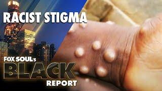 Monkeypox Stories Are Playing Into Racist Stereotypes! | FOX SOUL’s Black Report