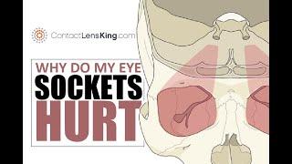 Why Do My Eye Sockets Hurt | Orbital Pain | Eye Pain | Reasons of Orbital Pain