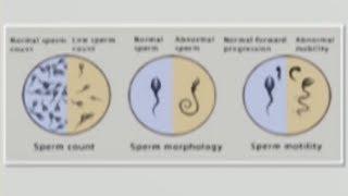 Male fertility issue: Oligospermia and Azoospermia | Usapang Pangkalusugan