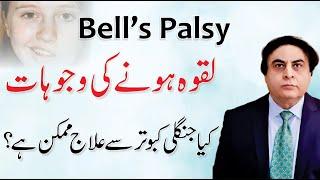 Bells Palsy - Laqwa ka Ilaj | Facial Paralysis Causes & Treatment By Dr. Khalid Jamil