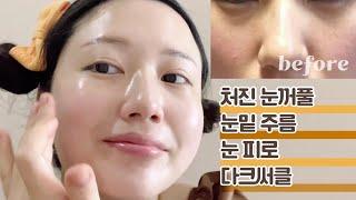 CC) 탄력있는 눈꺼풀, 눈밑, 미간, 전택궁, 눈가 마사지,  eyelid & under eyes massage