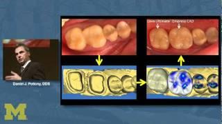 Applications & Considerations for Chairside Digital Dentistry