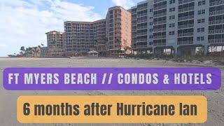 Fort Myers Beach // Condos & Hotels // Labeled