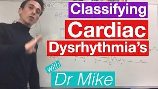 Cardiac dysrhythmias (arrhythmias) (common)