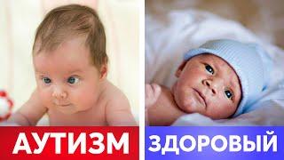 Ранние признаки АУТИЗМА! Должен знать КАЖДЫЙ РОДИТЕЛЬ!