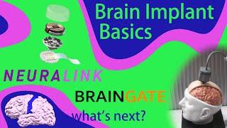 What Can You Do With a Brain Implant? Neuralink, BrainGate, and the Future