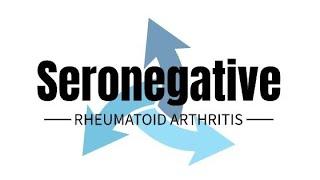 Seronegative Rheumatoid Arthritis #rheumatology #rheumatoid #seronegative