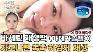 보습 미쳤다! 바세린에 마데겔 말고 '이것' 과 사용해보세요! 하얗고 탱탱하게! 노화 피부 안녕~바세린 얼굴 사용 방법 바세린X마데카솔팩 최신 업그레이드 버젼!