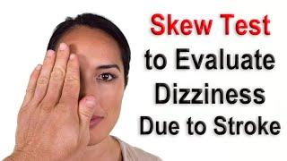 Skew Test to Evaluate Dizziness Due to Possible Stroke