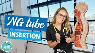 How To Insert A Nasogastric Tube » NG Tube » Nursing Skills