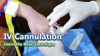 IV Cannulation - Learn the Basic Technique | IV Cannula