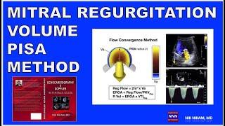 Mitral Regurgitation Severity | Echocardiography and Doppler | PISA Method| DR. Nik Nikam