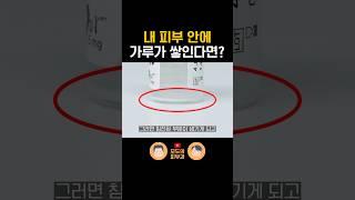 콜라겐 부스터 시술 시 결절 발생 이유는?